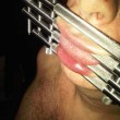 The Gag Order
